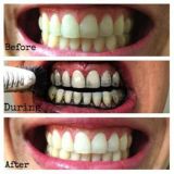 Miracle Teeth - bambusové uhlí na bělení zubů