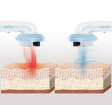 Ultrazvukový kavitační masážní přístroj proti celulitidě 3v1 s infračerveným zářením a elektrostimulací CELLYMAX